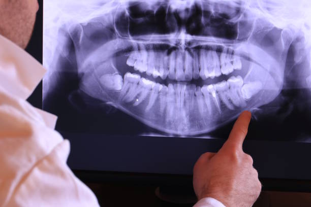Best Emergency Treatment for Toothache in Millersville, TN
